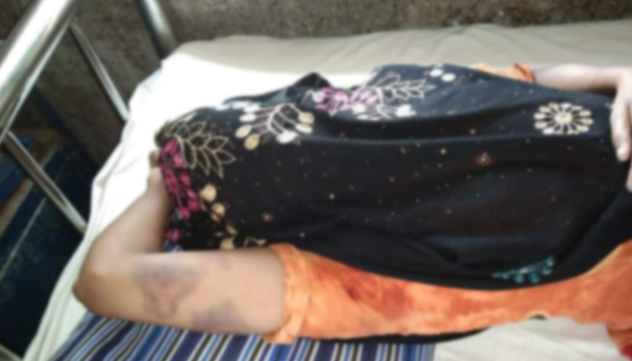 যৌতুক না পেয়ে মধ্যযুগীয় কায়দায় গৃহবধূ নির্যাতন