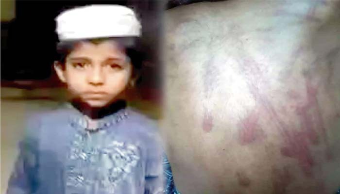 বেত্রাঘাতে মাদ্রাসার ৪ শিক্ষার্থী আহত, শিক্ষক গ্রেপ্তার