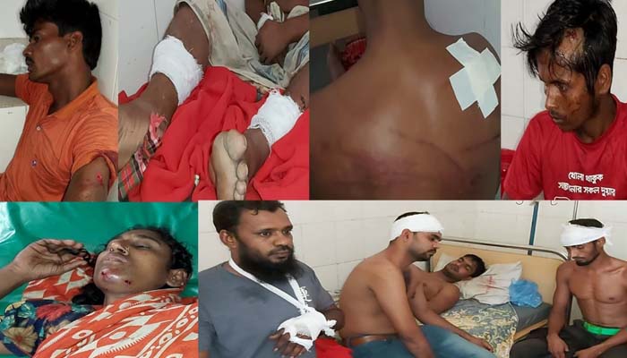 বাউফলে সংঘর্ষে ২৭ জন আহত