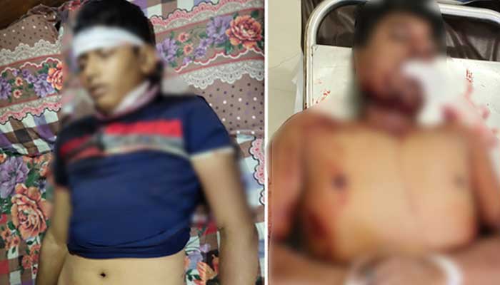 সাতকানিয়ায় পালিয়ে বাঁচলেন ইউপি চেয়ারম্যান, গুলিবিদ্ধসহ আহত ৩