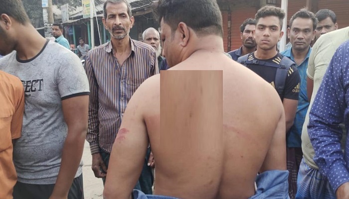 বাঘায় ডিশ লাইনের সংযোগকে কেন্দ্র করে হামলা, আহত ৫