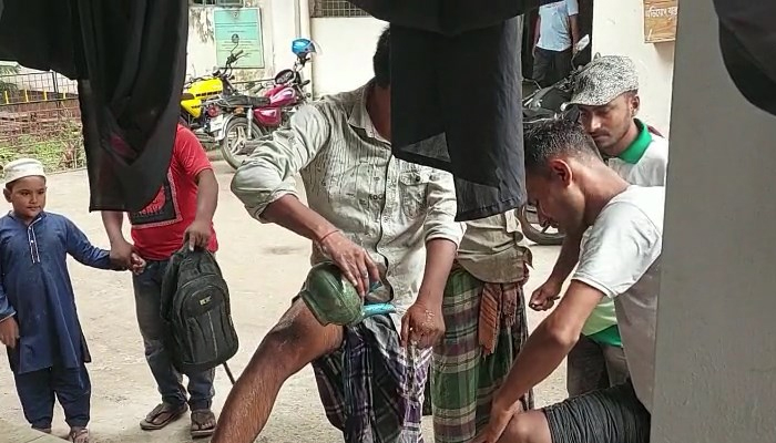 কালীগঞ্জে কুকুরের কামড়ে নারী-শিশু সহ ৪০ জন আহত