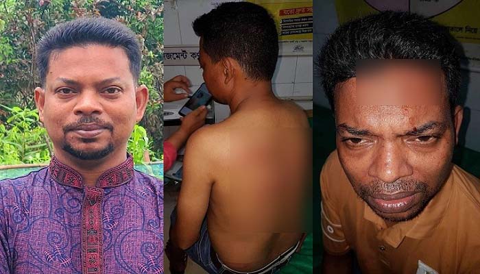 দিরাইয়ে সাংবাদিকের ওপর সন্ত্রাসী হামলা