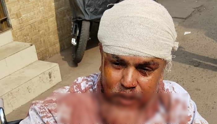 বেতন চাওয়ায় নিরাপত্তা কর্মীকে কুপিয়ে জখম