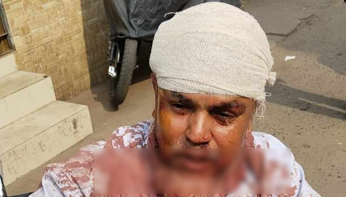 বেতন চাওয়ায় নিরাপত্তা কর্মীকে কুপিয়ে জখম