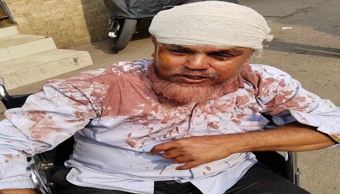 বেতন চাওয়ায় নিরাপত্তা কর্মীকে কুপিয়ে জখম