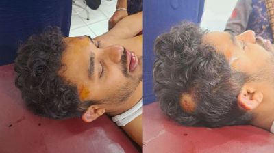 দুর্বৃত্তদের হামলায় গুরুতর আহত সময়ের আলোর নিজস্ব প্রতিবেদক