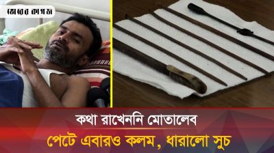 রোগীর পেট থেকে বের হলো লোহার সুঁচ, বাঁশের কাঠি,  প্লাস্টিকের বেল্ট