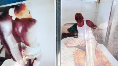 রায়পুরায় আধিপত্য বিস্তারের জেরে দু’পক্ষের সংঘর্ষ, ১২ জন গুরুতর আহত