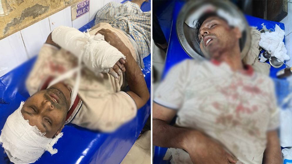 সোনাগাজীতে যুবলীগ নেতা আমজাদকে কুপিয়ে হত্যার চেষ্টা