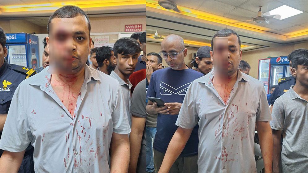 সাংবাদিক অলককে মেরে রক্তাক্ত করেছে স্টার কাবাবের স্টাফরা