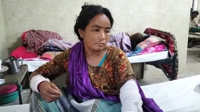 শিয়ালের কামড়ে নারীসহ আহত ১৪