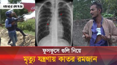 মৃত্যু যন্ত্রণা দিচ্ছে ফুসফুসের গুলি, টাকার অভাবে বন্ধ রমজানের চিকিৎসা