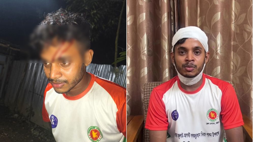 হামলার শিকার একই স্থানে গুলিবিদ্ধ হওয়া এনসিপি নেতা