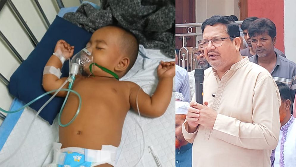 বিরল রোগে আক্রান্ত শিশু মিম, চিকিৎসার দায়িত্ব নিলেন বিএনপি নেতা শিমুল বিশ্বাস