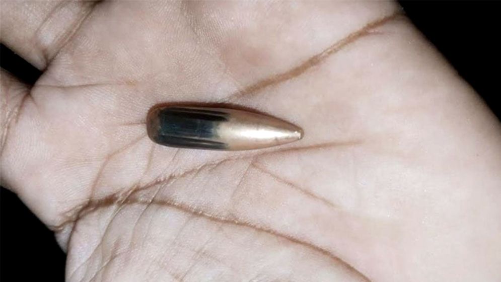 মিয়ানমার থেকে ছোড়া গুলিতে টেকনাফে নারী আহত