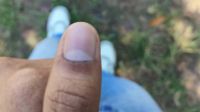 আঙুলের কালি মুছে যাওয়ার অভিযোগ ছাত্রদলের