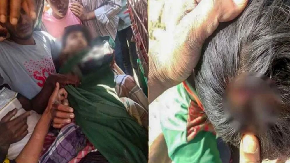 মিয়ানমার থেকে ছোড়া গুলিতে দুই জেলে গুলিবিদ্ধ