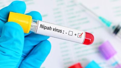 ৩৫ জেলায় ছড়িয়েছে নিপাহ ভাইরাস, হাসপাতালকে প্রস্তুত থাকার নির্দেশ