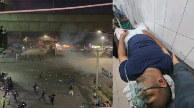 পুলিশের ব্যাপক লাঠিচার্জ, এমপি প্রাথী রনিসহ আহত অনেক