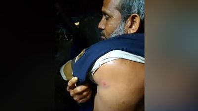 বঙ্গোপসাগরে জলদস্যুদের গুলিতে দুই জেলে আহত