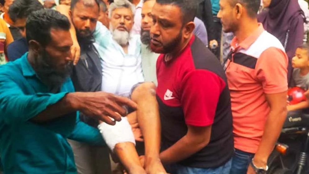 অতর্কিত হামলায় আওয়ামী লীগ নেতা আহত