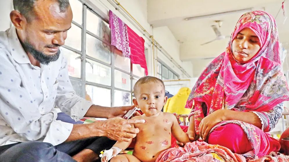 যেসব শিশুকে হামের টিকা না দেওয়ার নির্দেশ