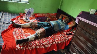 স্বেচ্ছাসেবক দলের নেতার দুই পা ভেঙ্গে দিল ‘সন্ত্রাসীরা’