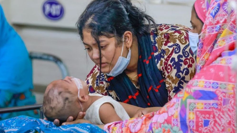 হাম ও হামের উপসর্গে আরো ১১ জনের মৃত্যু