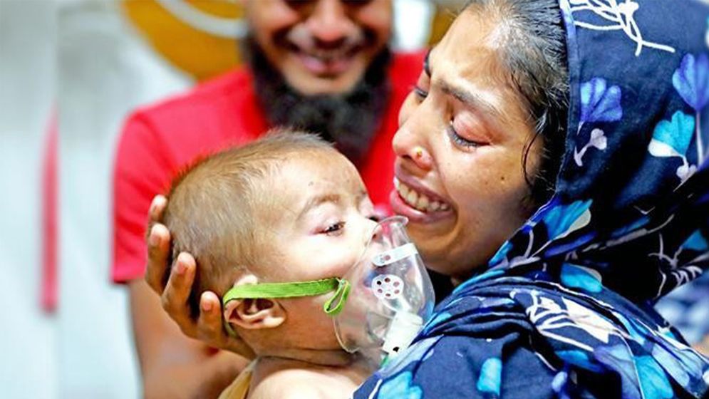 হাম ও উপসর্গে আরো ৯ শিশুর মৃত্যু