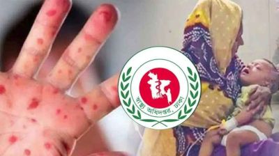 দুপুরে হাম পরিস্থিতি নিয়ে স্বাস্থ্য অধিদপ্তরের ব্রিফিং