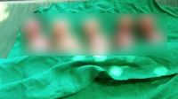 বিয়ের ১০ বছর পর একসঙ্গে সাত সন্তানের জন্ম, বাঁচল না কেউ