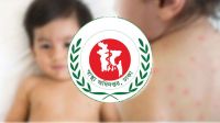 একদিনে হাম ও উপসর্গে আরো ৯ শিশুর মৃত্যু